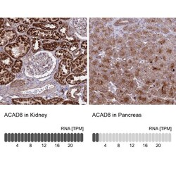 ACAD8 Antibody, Novus Biologicals 0.1mL; Unlabeled:Antibodies, Polyclonal